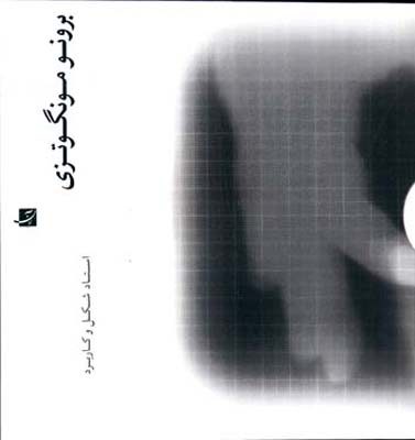 برونو مونگوتزی